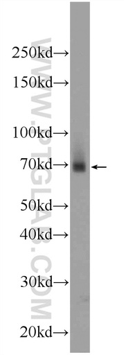 [24508-1-AP-150UL] ZNF512 Polyclonal antibody