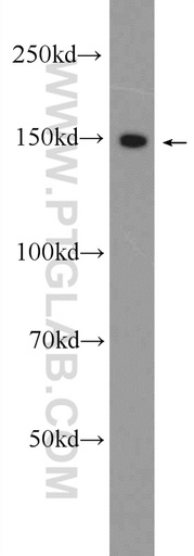 [24513-1-AP-150UL] CPS1 Polyclonal antibody