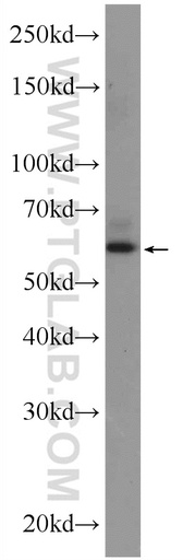 [24514-1-AP-20UL] ZNF846 Polyclonal antibody
