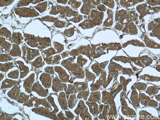 [24519-1-AP-20UL] FBXO41 Polyclonal antibody