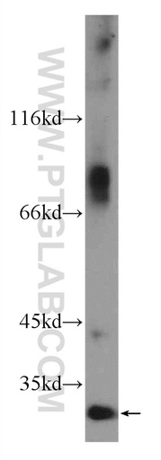 [24522-1-AP-20UL] C16orf72 Polyclonal antibody