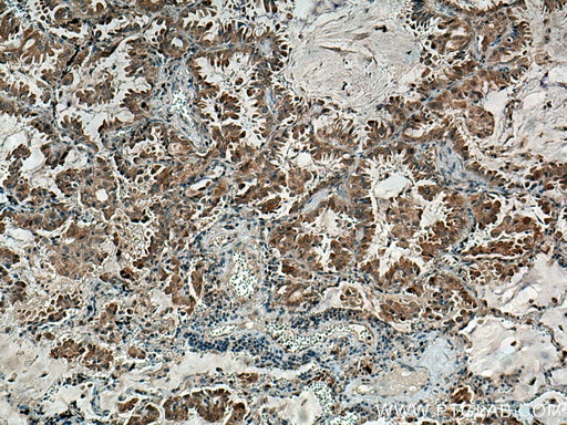 [24524-1-AP-150UL] RNF145 Polyclonal antibody