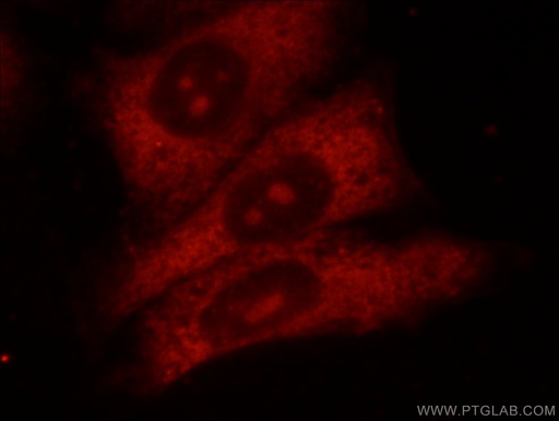 [24529-1-AP-20UL] HPSE Polyclonal antibody