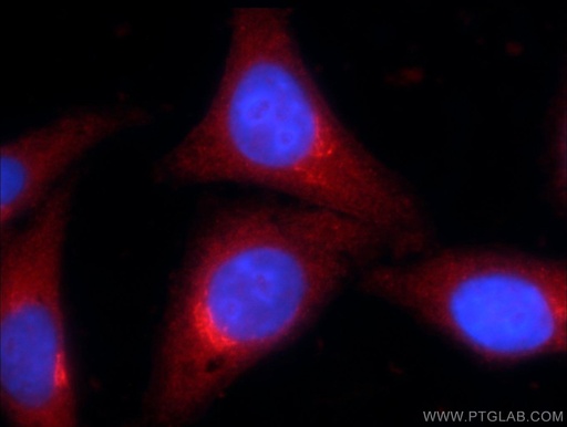 [24531-1-AP-20UL] ZNF140 Polyclonal antibody