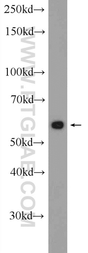 [24532-1-AP-150UL] SESN3 Polyclonal antibody