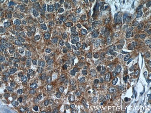 [24536-1-AP-150UL] RNF25 Polyclonal antibody