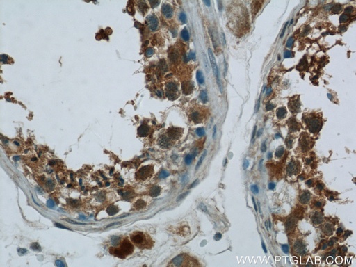 [24543-1-AP-20UL] ZNF746 Polyclonal antibody