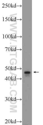 [24548-1-AP-150UL] TBCEL Polyclonal antibody
