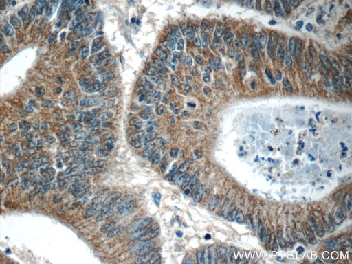 [24549-1-AP-20UL] C8orf77 Polyclonal antibody