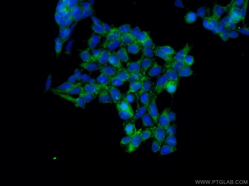 [24550-1-AP-150UL] AMOT Polyclonal antibody