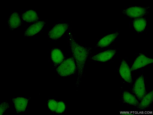 [24556-1-AP-150UL] HP1BP3 Polyclonal antibody
