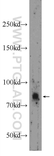 [24559-1-AP-150UL] USP35 Polyclonal antibody