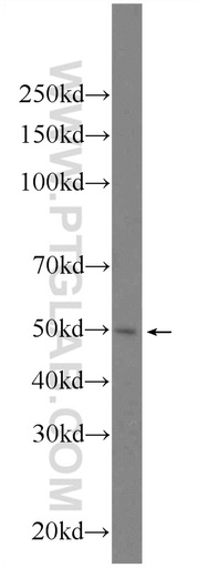 [24560-1-AP-150UL] FYTTD1 Polyclonal antibody