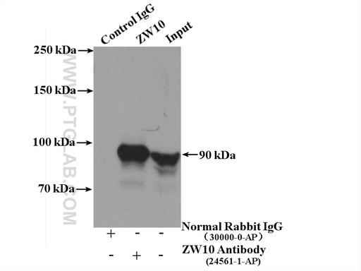 [24561-1-AP-20UL] ZW10 Polyclonal antibody