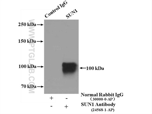 [24568-1-AP-150UL] SUN1 Polyclonal antibody