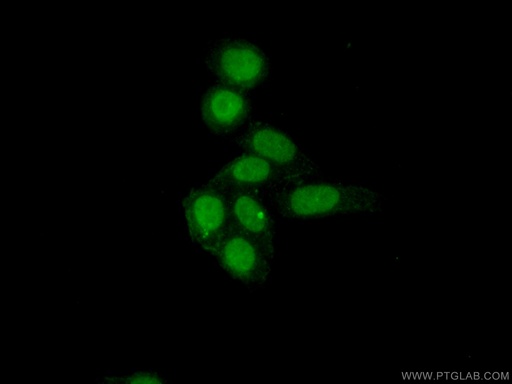 [24572-1-AP-150UL] NF45 Polyclonal antibody