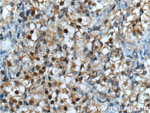 [24573-1-AP-20UL] NR2F1 Polyclonal antibody