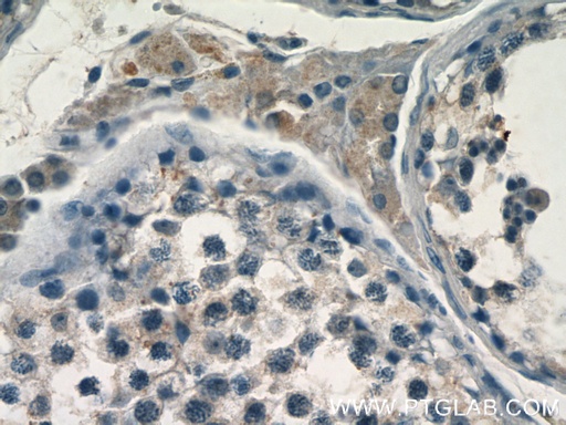 [24574-1-AP-150UL] FAM133A Polyclonal antibody