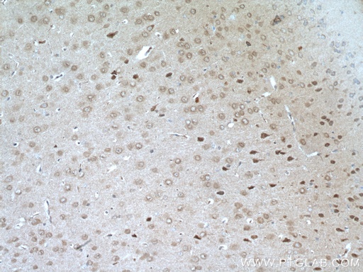 [24576-1-AP-20UL] RIM1 Polyclonal antibody