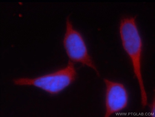[24578-1-AP-150UL] HEATR2 Polyclonal antibody