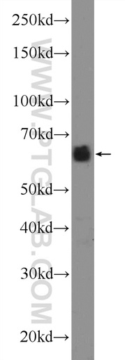 [24579-1-AP-150UL] CCDC67 Polyclonal antibody