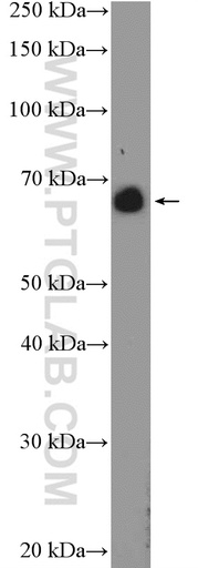 [24581-1-AP-20UL] ANKRD34B Polyclonal antibody