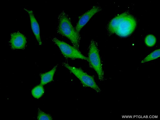 [24582-1-AP-20UL] SLC37A1 Polyclonal antibody