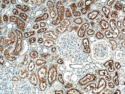 [24584-1-AP-20UL] SLCO4C1 Polyclonal antibody