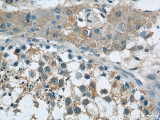 [24585-1-AP-150UL] TEX15 Polyclonal antibody