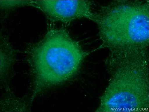 [24587-1-AP-150UL] DSG1 Polyclonal antibody