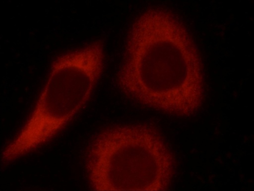 [24589-1-AP-150UL] LCTL Polyclonal antibody