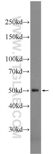 [24590-1-AP-150UL] SEPT14 Polyclonal antibody