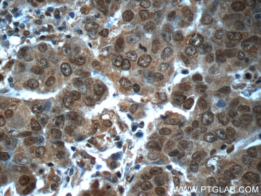 [24593-1-AP-150UL] POTEA Polyclonal antibody