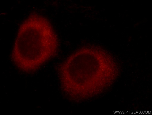 [24594-1-AP-20UL] TTC37 Polyclonal antibody