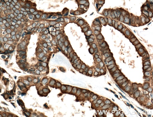 [24595-1-AP-20UL] FOXRED1 Polyclonal antibody