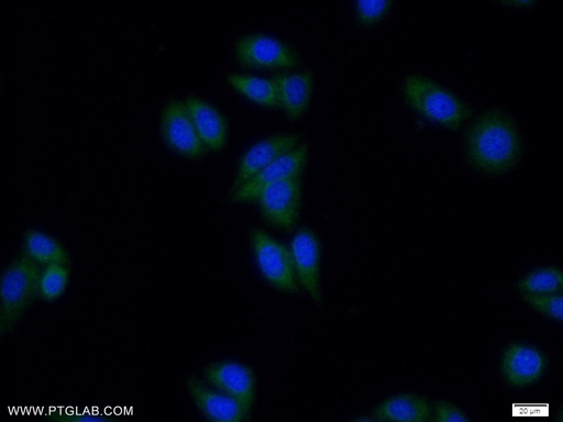 [24596-1-AP-20UL] ZNF654 Polyclonal antibody