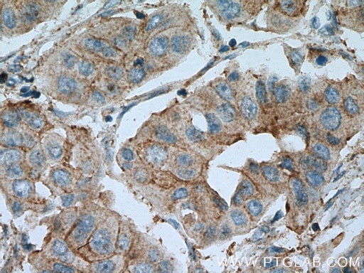 [24598-1-AP-150UL] PAGE3 Polyclonal antibody