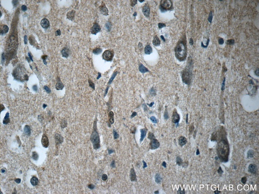 [24599-1-AP-20UL] RAB3GAP2 Polyclonal antibody