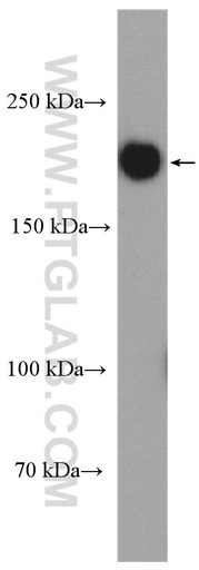 [24601-1-AP-150UL] Tuberin Polyclonal antibody
