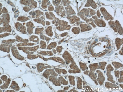 [24603-1-AP-150UL] UPB1 Polyclonal antibody