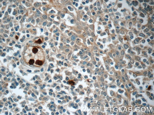 [24611-1-AP-20UL] LY6G5B Polyclonal antibody