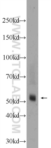 [24616-1-AP-20UL] TMPRSS5 Polyclonal antibody
