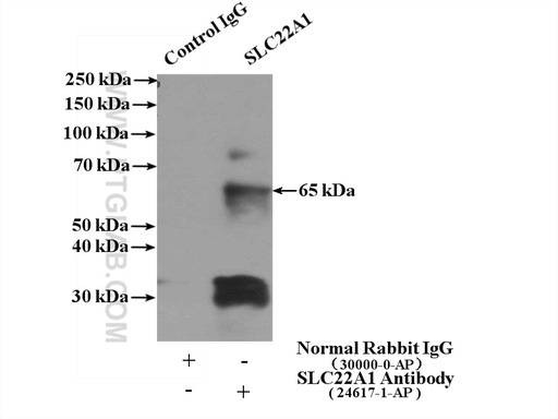 [24617-1-AP-150UL] SLC22A1 Polyclonal antibody