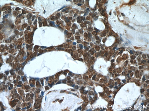 [24624-1-AP-150UL] PHF2 Polyclonal antibody