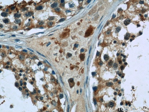 [24629-1-AP-150UL] C17orf46 Polyclonal antibody