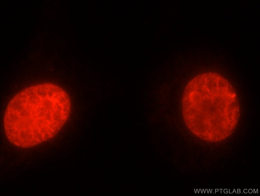 [24641-1-AP-150UL] TOP2A Polyclonal antibody