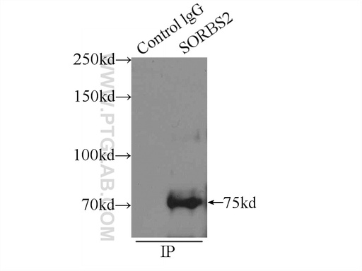 [24643-1-AP-20UL] SORBS2 Polyclonal antibody