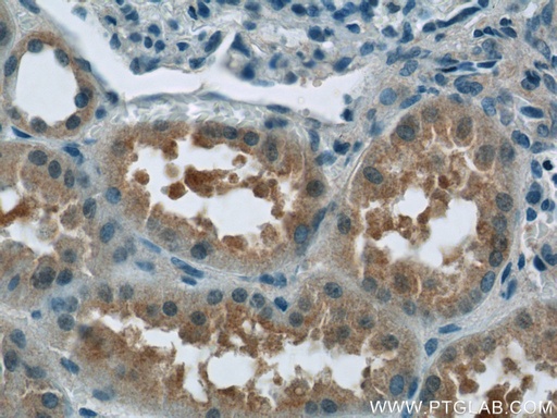 [24646-1-AP-20UL] C12orf65 Polyclonal antibody