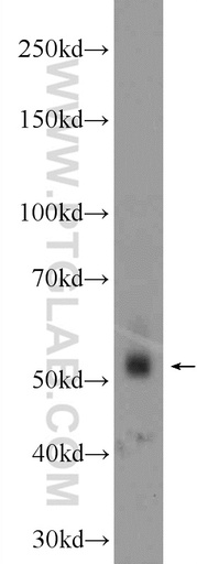 [24647-1-AP-20UL] ZNF71 Polyclonal antibody