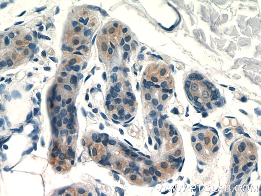 [24648-1-AP-150UL] SPRR2F Polyclonal antibody